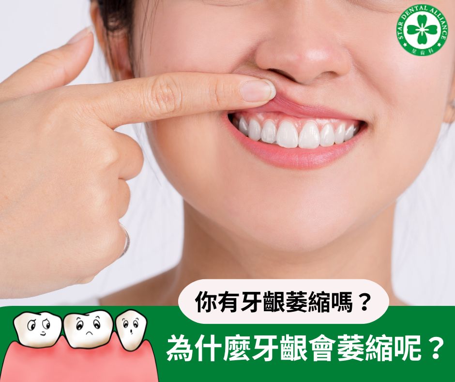 牙齦萎縮_Stardental