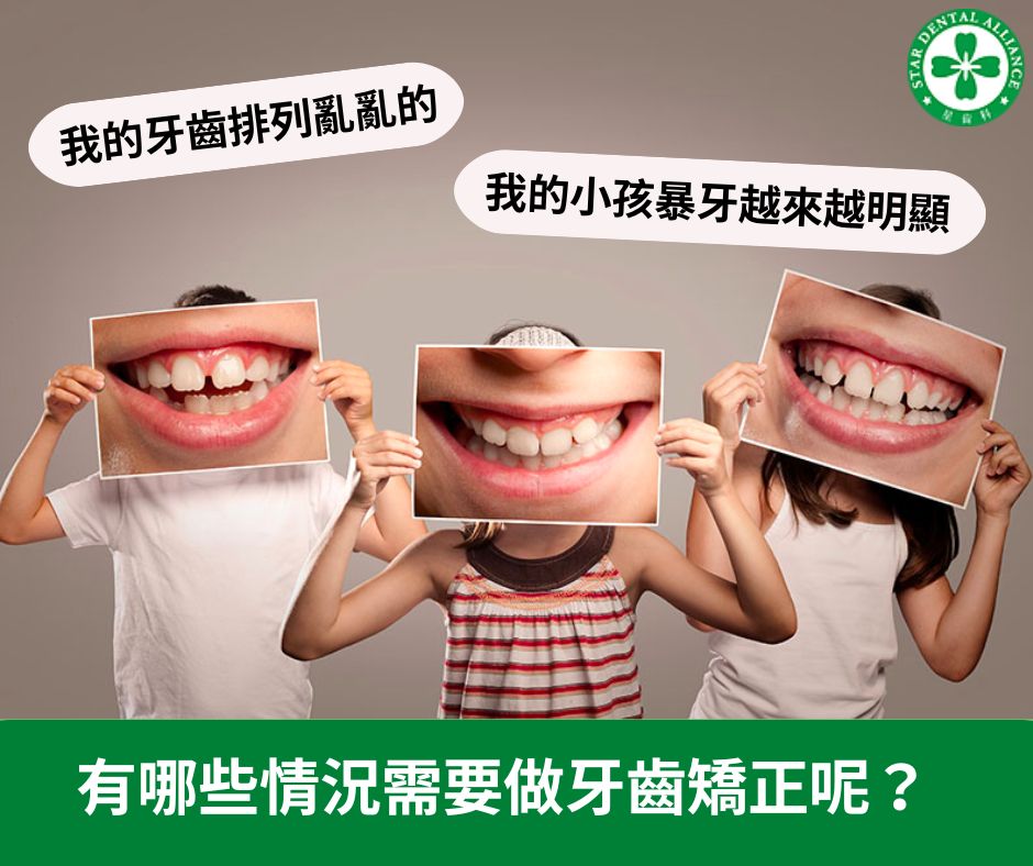 有哪些情況是要做牙齒矯正_Stardental