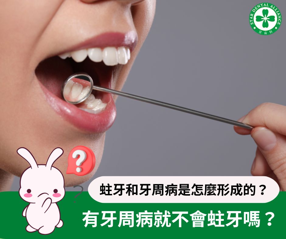 有牙周病就不會蛀牙了嗎_Stardental