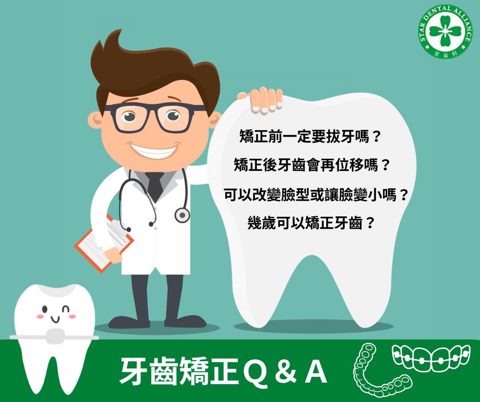 牙齒矯正常見問題_Stardental