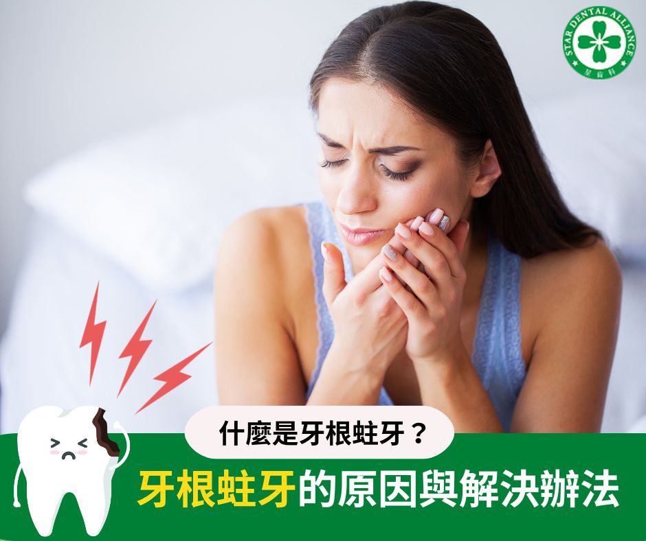 牙根蛀牙的原因與解決辦法_Stardental