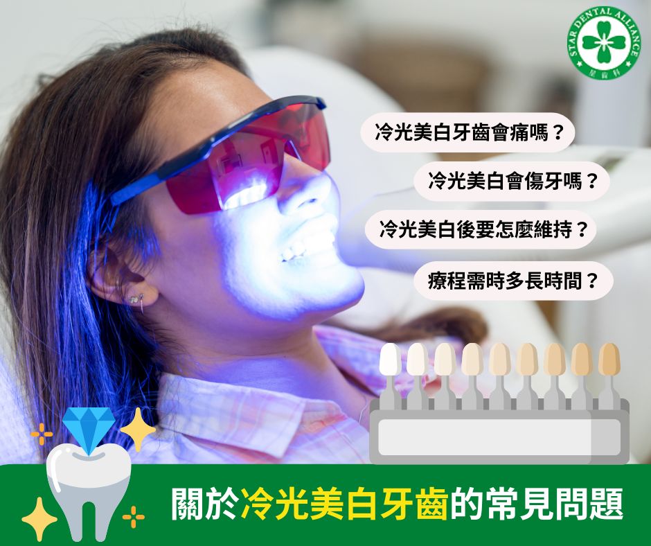 冷光美白常見的問題_Stardental