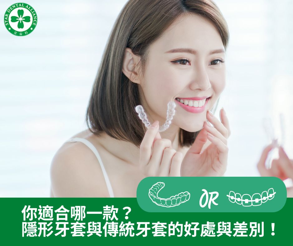 你適合哪一款？隱形牙套與傳統牙套的好處與差別-Stardental