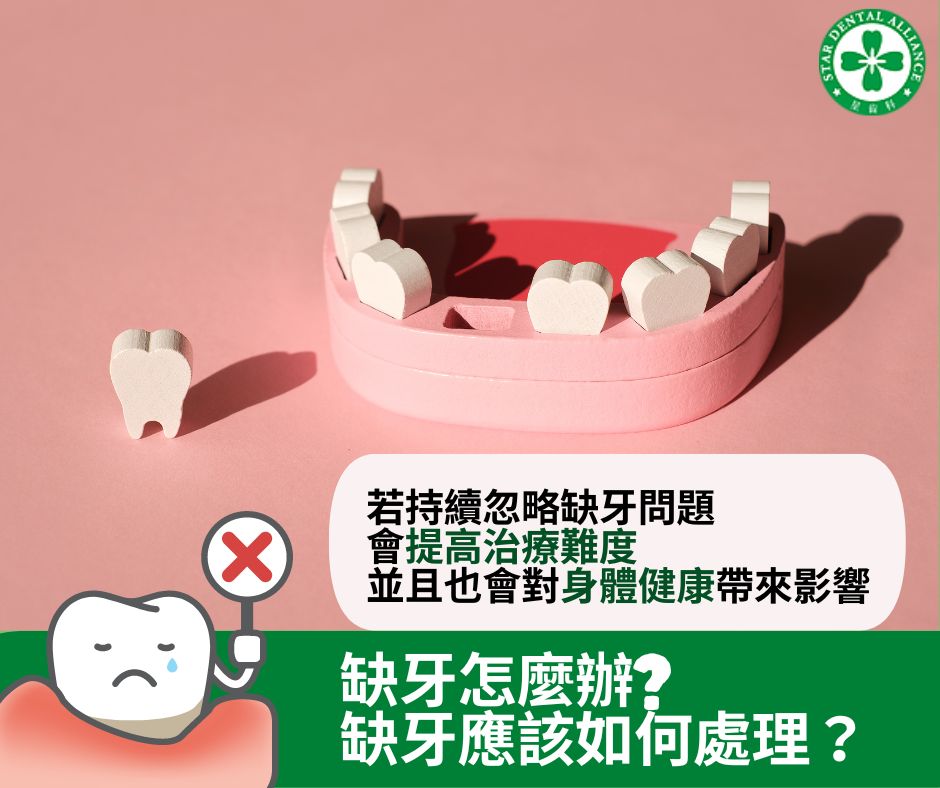 缺牙怎麼辦_Stardental