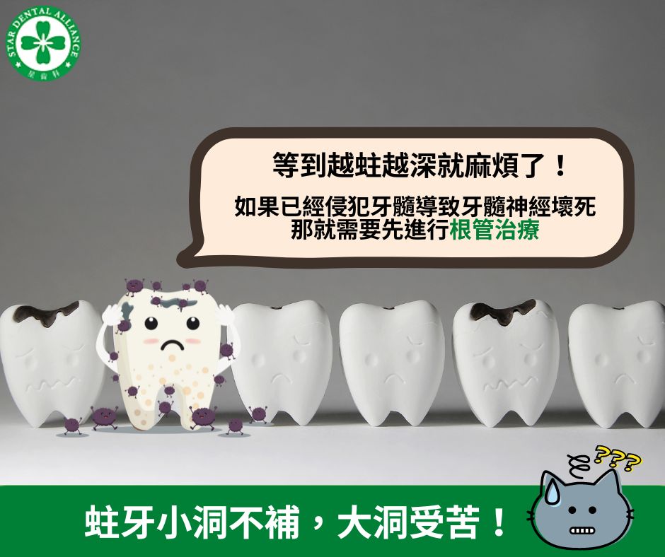 蛀牙小洞不補，大洞受苦-Stardental