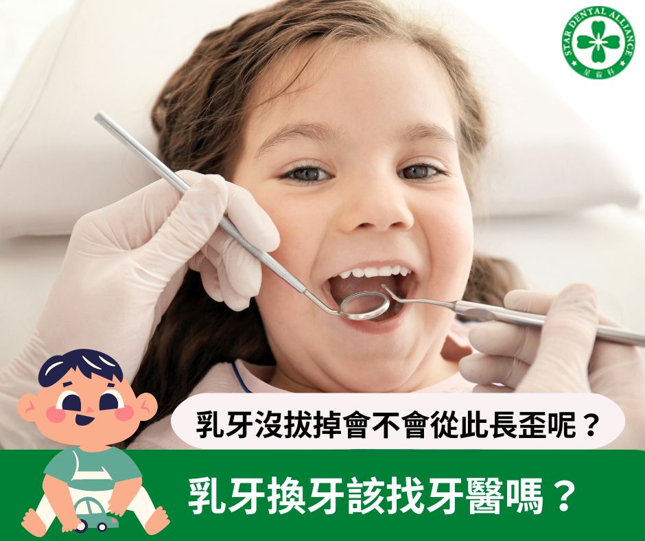 乳牙換牙該找牙醫嗎-Stardental