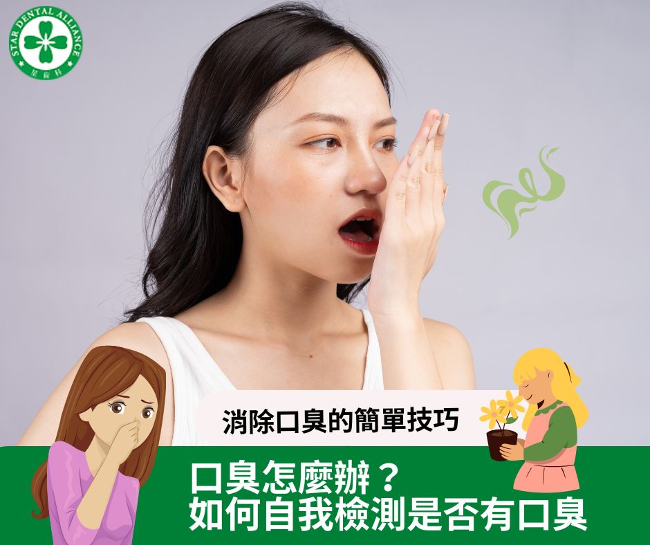 口臭怎麼辦？教你幾個方法自我檢測是否有口臭-Stardental