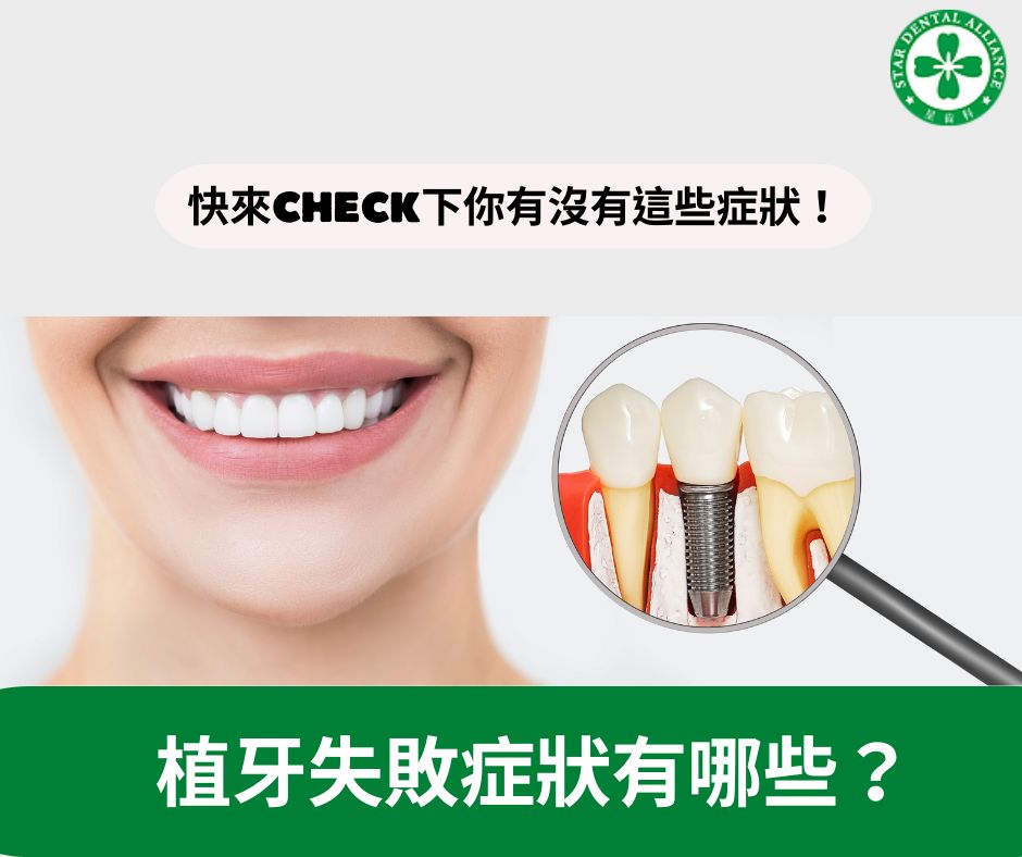 植牙失敗症狀有哪些？ Stardental