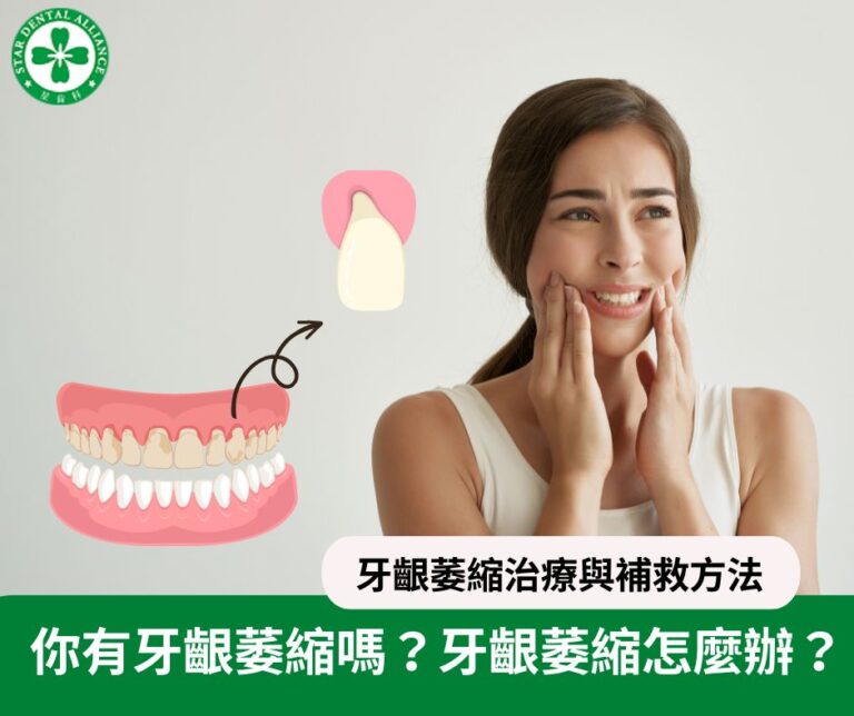 你有牙齦萎縮嗎？牙齦萎縮怎麼辦？Stardental