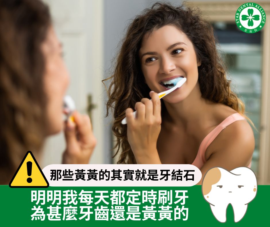 明明我每天都定時刷牙，為甚麼牙齒還是黃黃的_Stardental