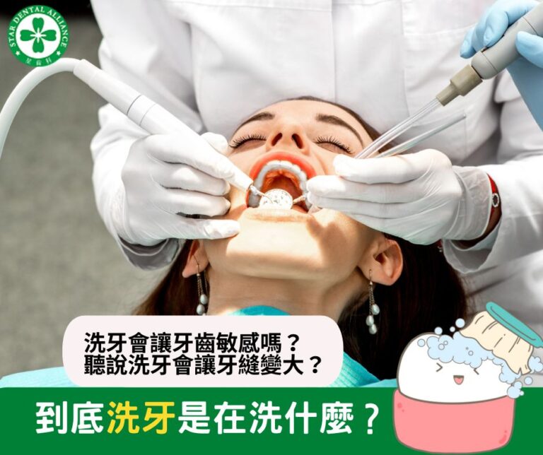 香港洗牙＿中環牙科＿Stardental