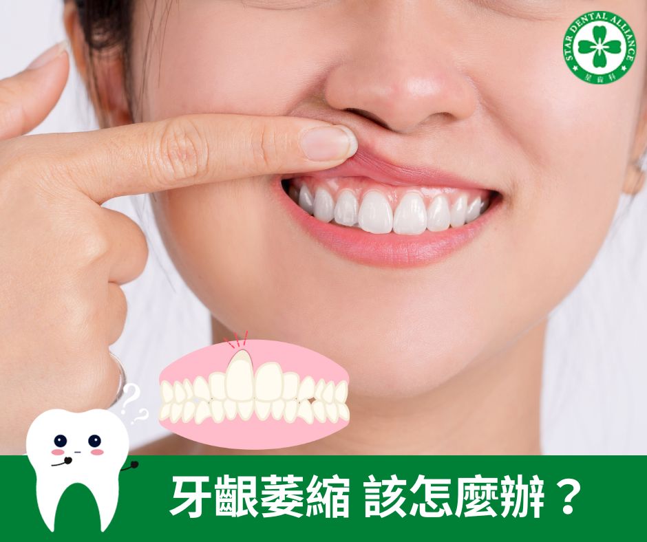 牙齦萎縮該怎麼辦？_stardental