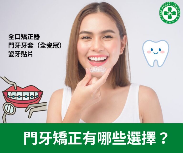 門牙矯正有哪些選擇？