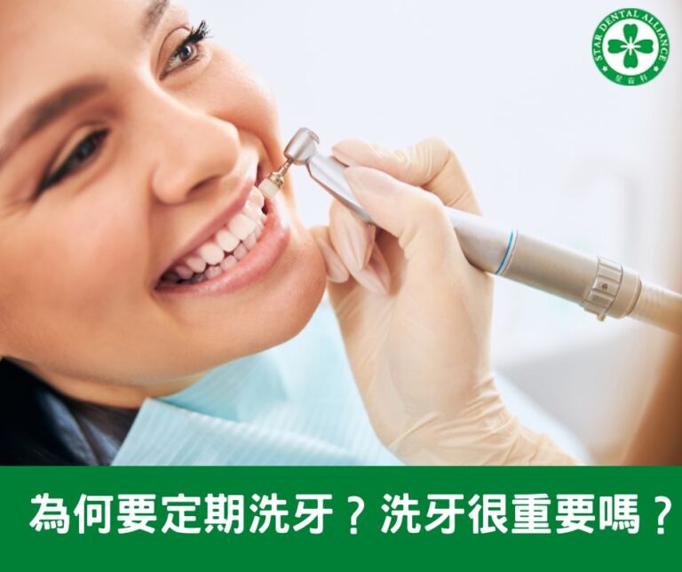 為何要定期洗牙？洗牙很重要嗎？