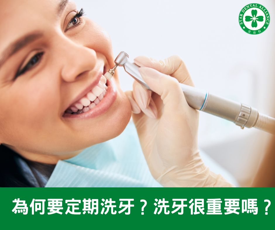為何要定期洗牙？洗牙很重要嗎？