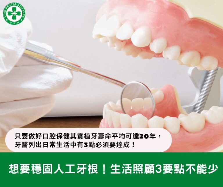 想要穩固人工牙根！生活照顧3要點不能少